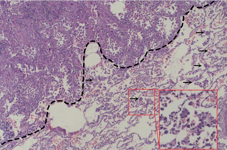 Hematoxylin-eosin staining for bronchi tissue.